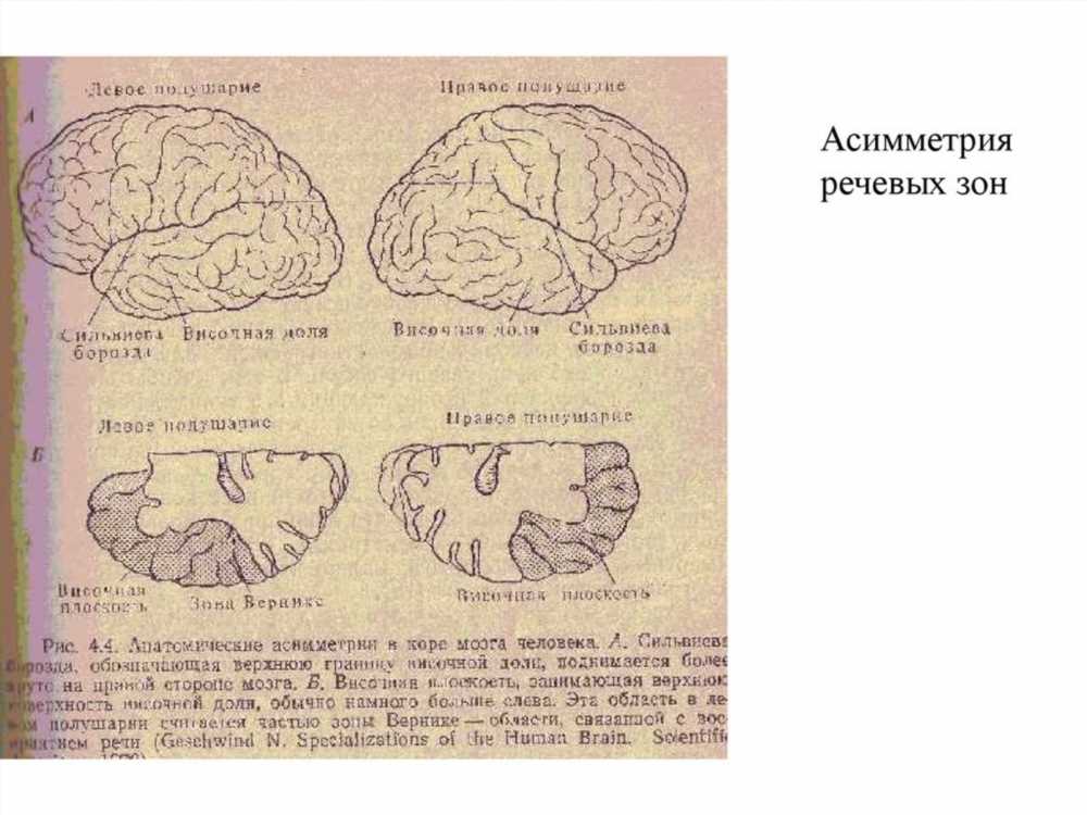Большие Полушария Головного Мозга: Функциональная Межполушарная Асимметрия