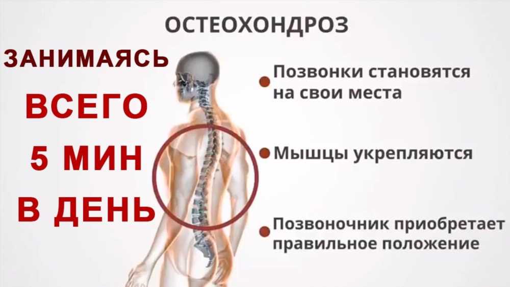 Остеохондроз позвоночника: причины, симптомы и эффективное лечение