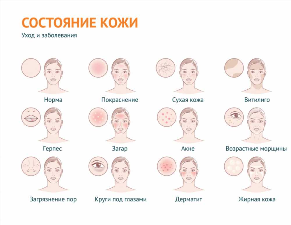 Причины сухости кожи: основные факторы и способы их устранения