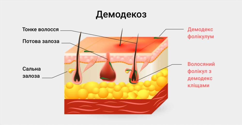 Все, что нужно знать о подкожном клеще: симптомы, лечение и профилактика